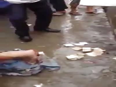 Man loses leg in accident