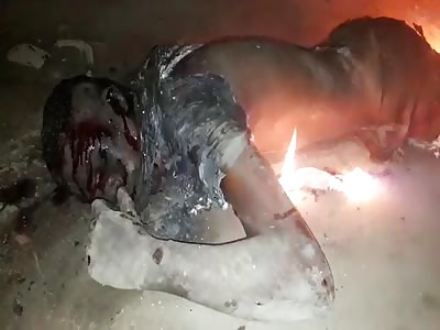 Shocking :man burning and agonizing after beating  