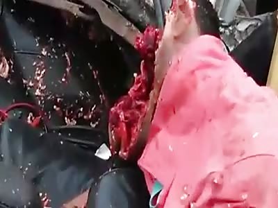 GORE: Head destroyed in Horrific accident