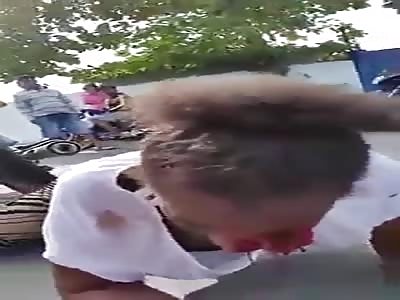 woman have face dstroyed in accident