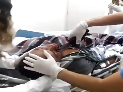 Removing a knife from a patient's face,