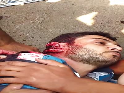 Dying Man After Being Shot In The Head