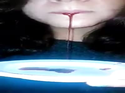  Woman cuts her tongue #1de10