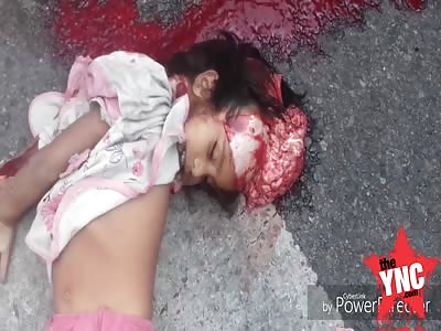 young girl named Shashi Pandey lost her brains in hyderabad