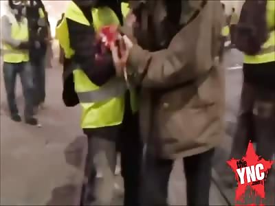 (Better Quality) Gilets Jaunes Protester Loses Hand to Explosion in Bordeaux, France