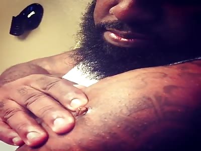 trae the truth squeezes bullet out of arm