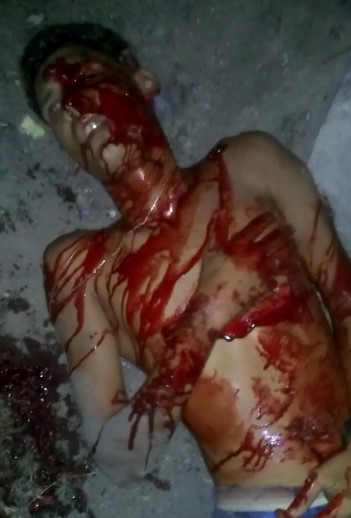 Bloody Crimes Scenes Happened Today in Brazil