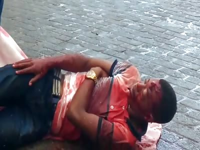 Another thief in agony after get brutally beaten