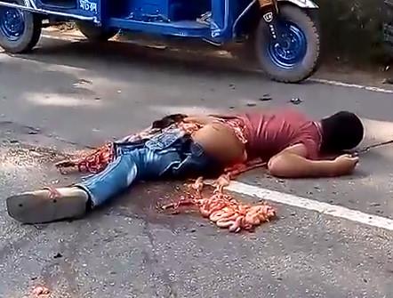 Man left with his Guts all over the Road through his ass