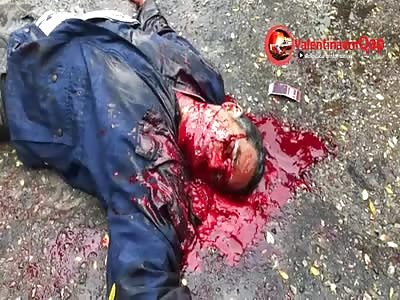 Blood Pours like a Waterfall after Shot in the Head (more footage)