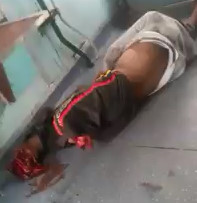 Failed Suicide Attempt in Train Lines