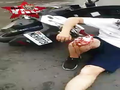  Young man destroys the wheelchair when suffering a motorcycle accident