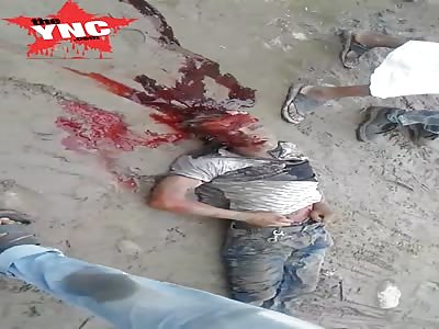 Mans legs skinned and anothers head split wide open after accident