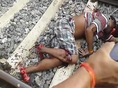 Feet cut off and face mangled by a train