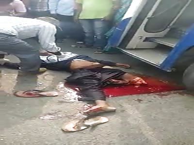 Man Was Killed and Leg Brutally Torn off by a Bus