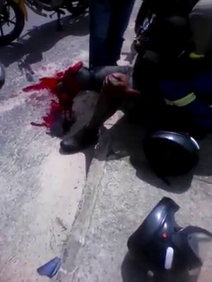 Man Leg got Ripped off in Accident