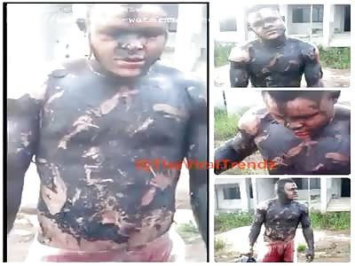Man Was Badly Burned While Trying to Steal Oil From a Transformer