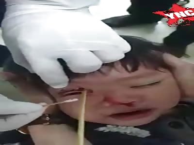 Wtf, the boy with a stick embedded in the eye