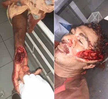 Gruesome Machete Execution Aftermath