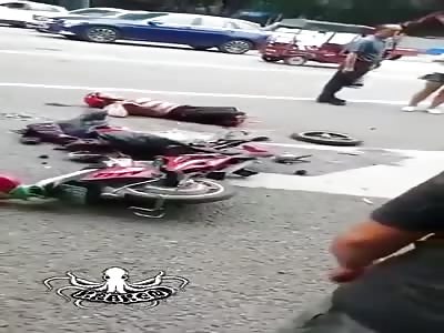 horrible motorcycle accident, he loses his legs