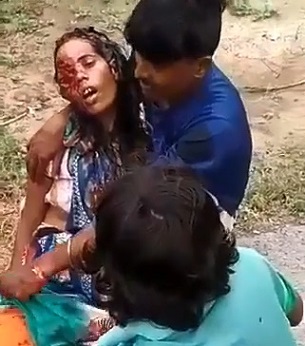 Woman Dying With The Skull Cracked