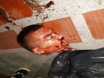 This Rioter Tortured By Police In Colombia Is Now Puzzle