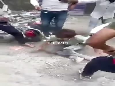 Man brutally beaten, with broken legs