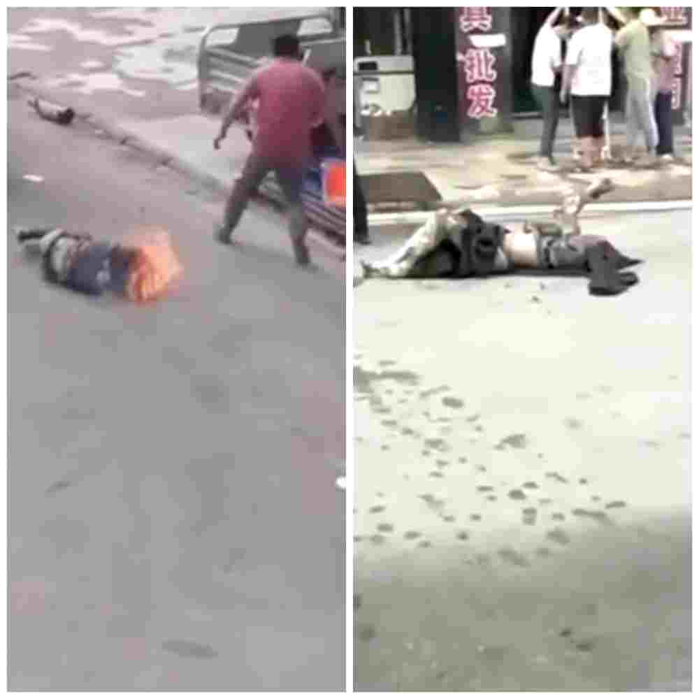 man burning after fire in china