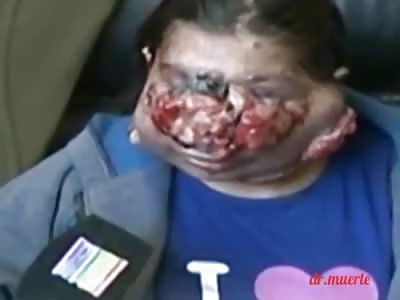 strange disease on a woman's face