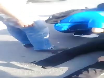 The boy convulses after an accident