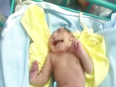 Very strong video not suitable for sensitive. Baby with malformation in various parts of the body