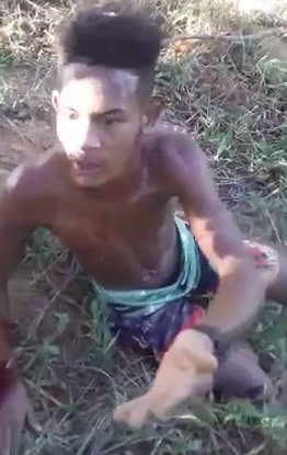 tortured man in brazil great cut on the knee, then escapes and is shot to death