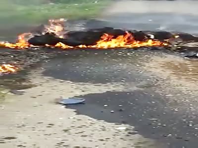 the man gets injured on his motorcycle and ends up completely burned
