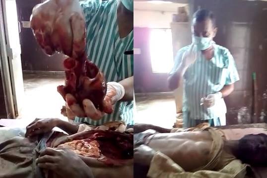 Autopsy man in India