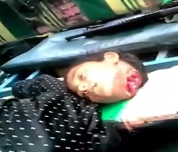 Indian Girl Beheaded after the accident 