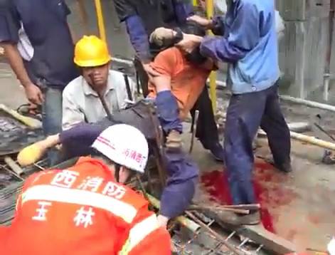 Construction Worker impaled by Iron Rods receives Help
