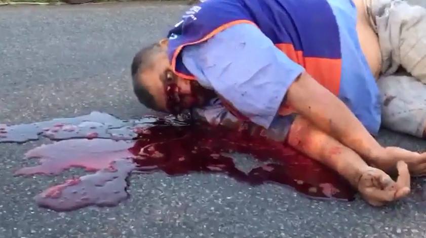 Man Lies on the Street with his open forehead and Vomiting Blood After accident