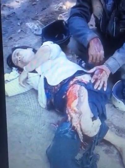 Asian Woman's Leg Ripped to Shreds after Terrible Accident