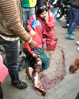 Elderly lady with shredded foot after Accident 