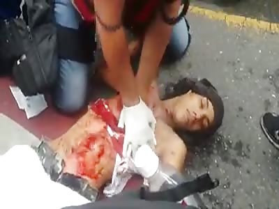 Attempted CPR on dead Venezuelan guy.