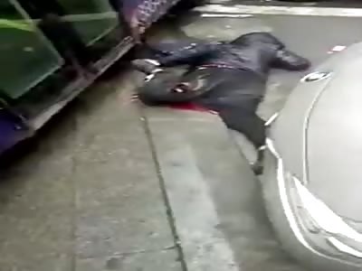 Chinese mans leg crushed by a bus.