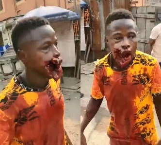  DAMN! Mouth Destroyed By Police Bullet