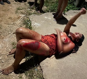 Woman Was Brutally Beaten in Brazil