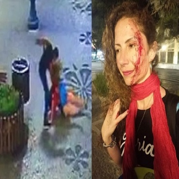 Journalist Is Stabbed on the Street and Appears Bloody on Social Networks
