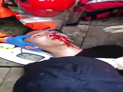 Hong Kong Protester got shot by police - Signs of brain damage shown on scene.