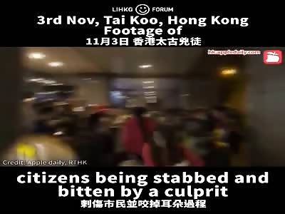 Hong Kong politician had his ear bitten off ï¼ˆpart 2ï¼‰