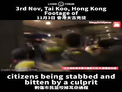 Hong Kong politician had his ear bitten off ï¼ˆpart 3ï¼‰
