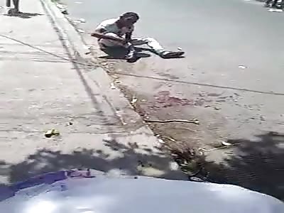 Victim of Machete Attack