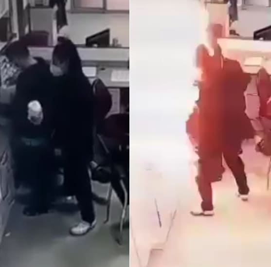 Moron Nurse Sets Himself And Co-Workers On Fire