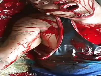 *GRAPHIC* Dying Man Spews Waterfall of Blood 